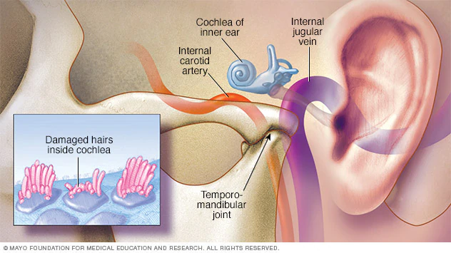 Natural tinnitus treatment guide for ear ringing relief 2025