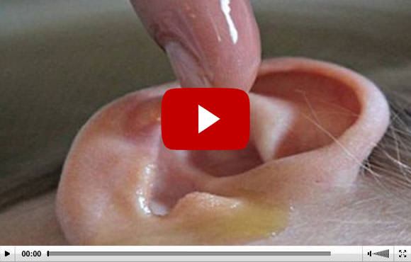 Natural Tinnitus Treatment